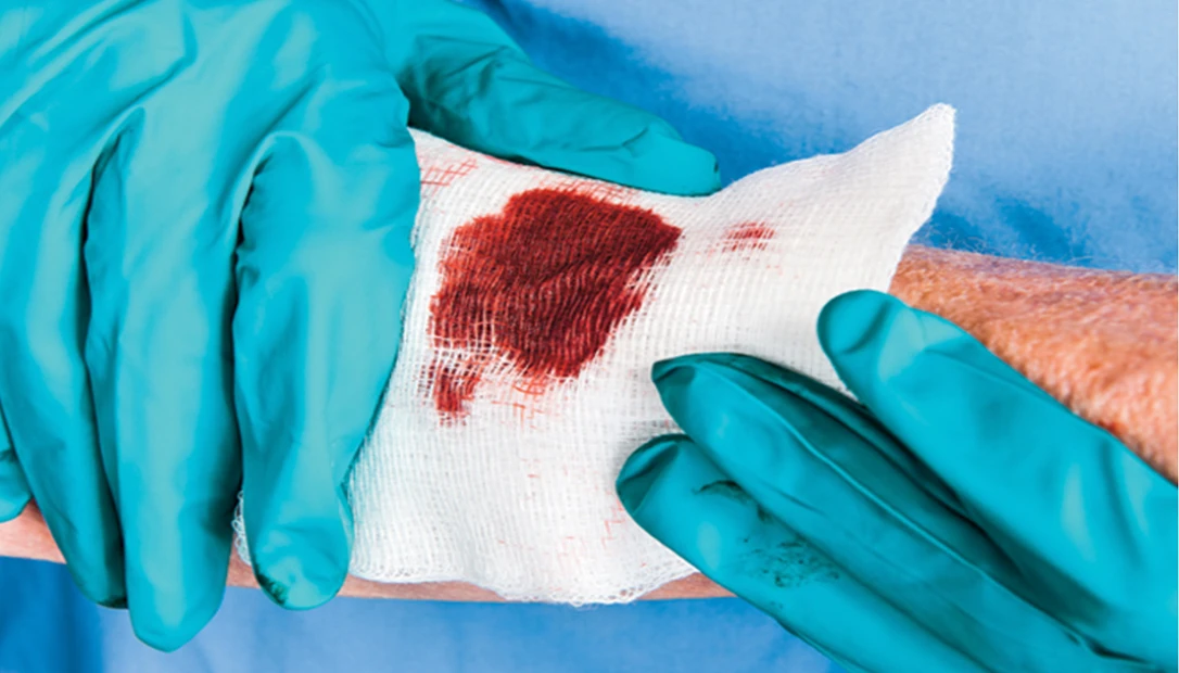 Doig bites can be very bad if left untreated.