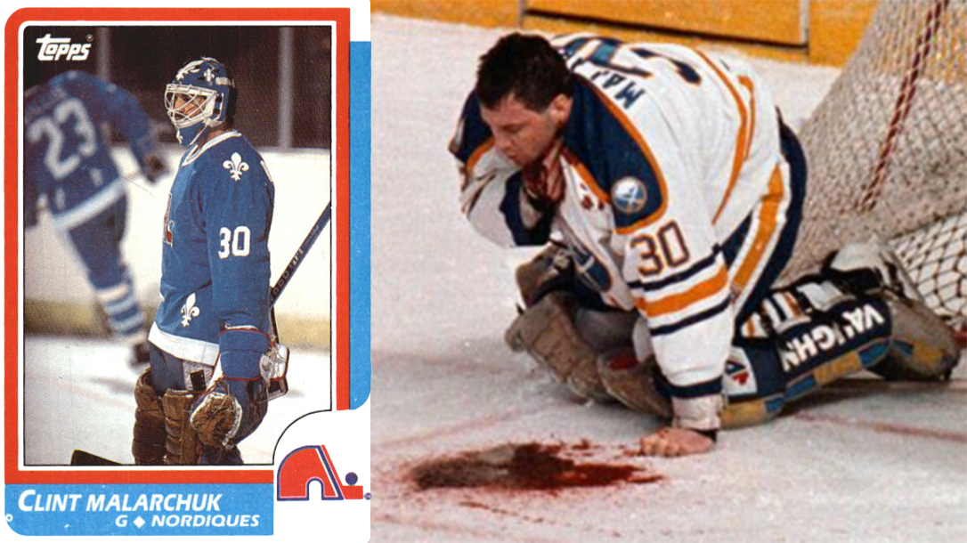 The blade of the skate hit the right side of the goalie’s neck, severing his carotid artery and partially cutting his jugular vein.