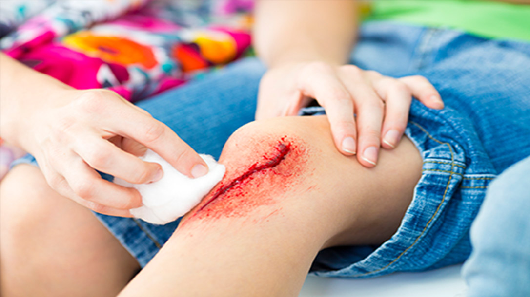Not all deep wounds require suturing.