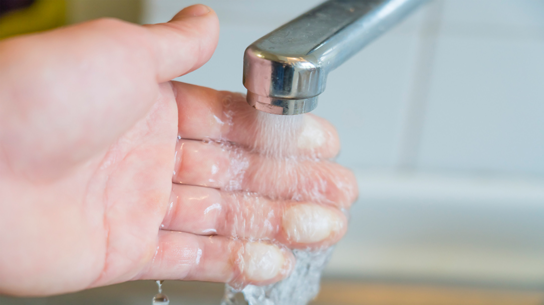 A minor burn at home can quickly turn bad if not treated correctly.
