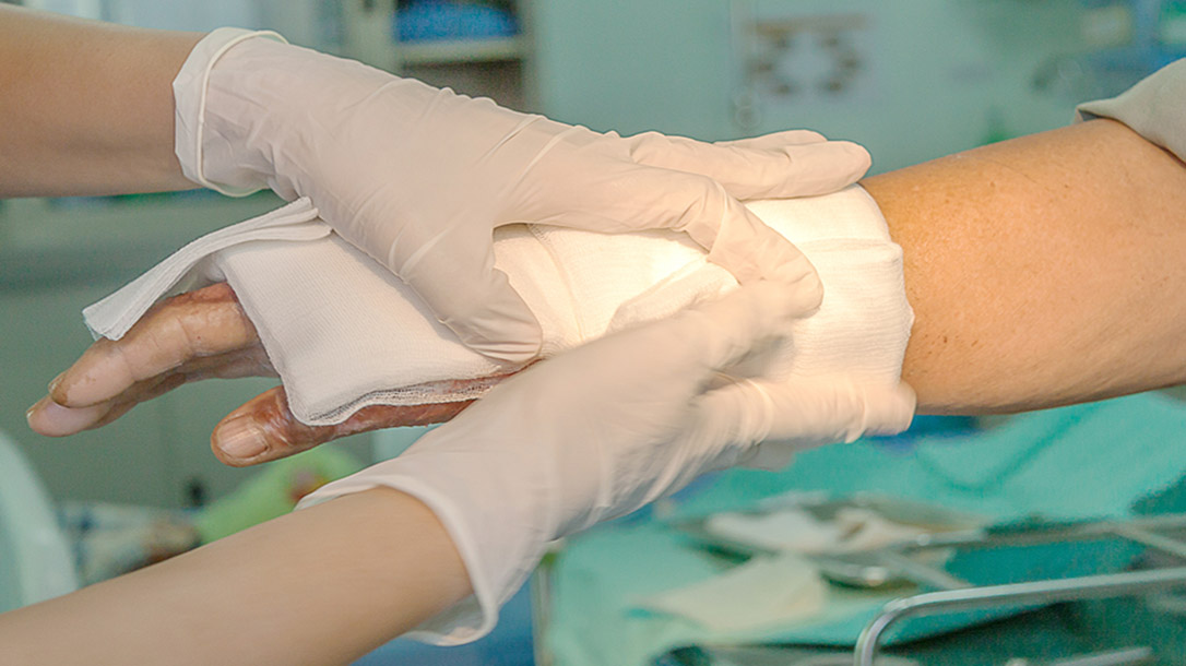 knowing how to treat a burn is a very important skill.